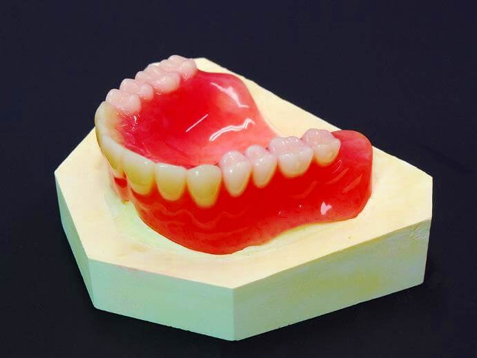 プラスチック製の総入れ歯（保険診療）