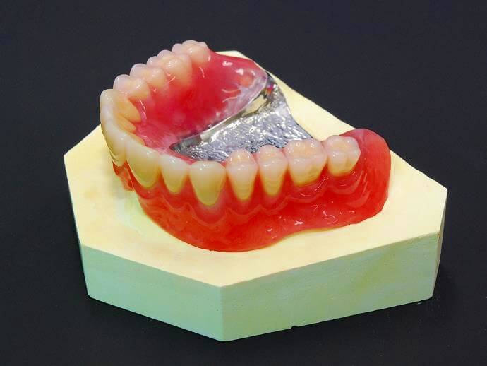 金属製の総入れ歯（自費診療）